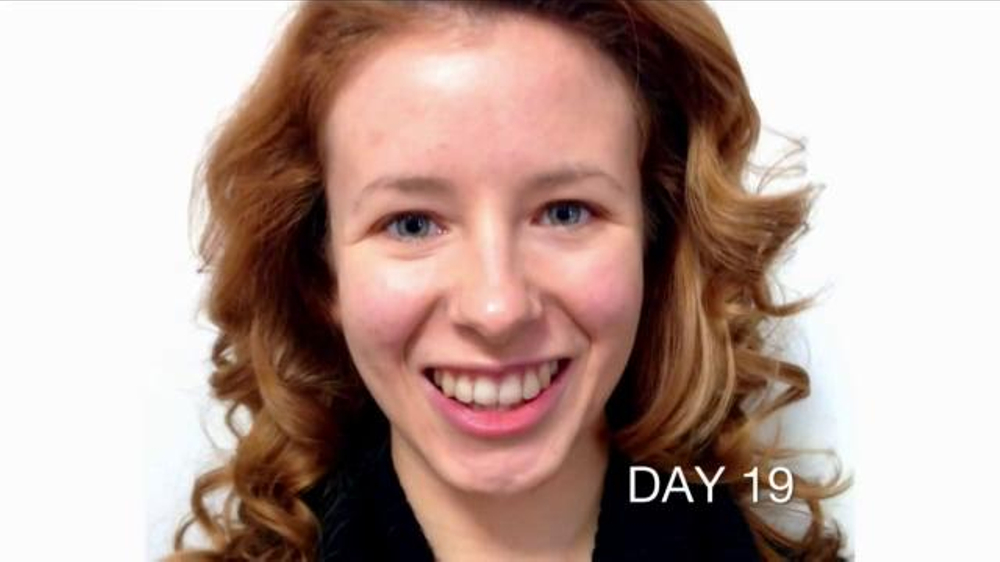 Neutrogena Rapid Clear TV Commercial, 'Acne Before & After: Angela's Story'