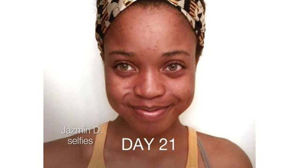 Neutrogena Rapid Clear Stubborn Acne TV Commercial, 'Jazmin's Story'