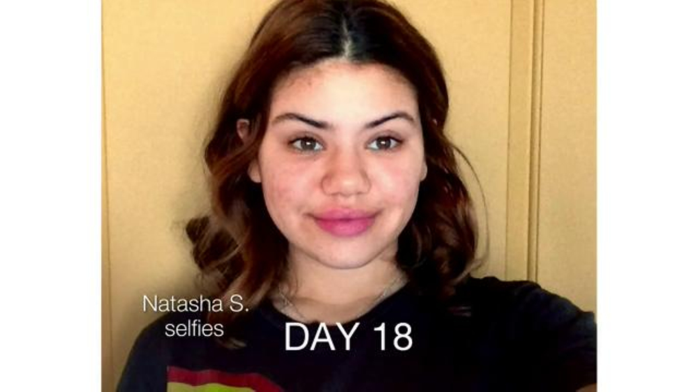Neutrogena Rapid Clear Stubborn Acne TV Commercial, 'Natasha's Story'