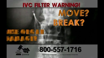 Pulaski Law Firm >> IVC Filter Justice TV Commercial, 'Serious Complications ... Pulaski Law Firm >> IVC Filter Justice TV Commercial, 'Serious Complications ...