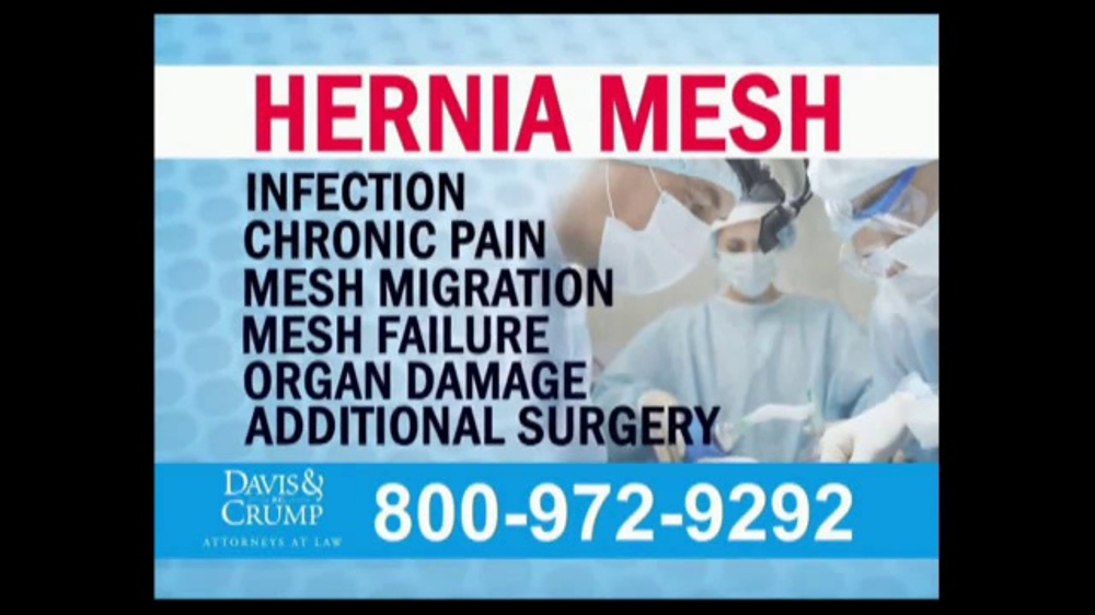 Hernia Mesh Failure Years Later Hernia Mesh Lawsuits in 2020 Hernia repair, Personal